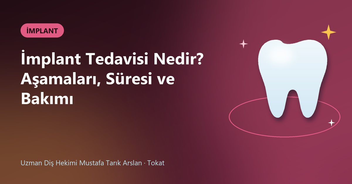 İmplant Tedavisi Nedir? Aşamaları, Süresi ve Bakımı – Uzm. Dt. Mustafa Tarık Arslan blog kapak görseli